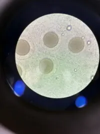 현미경 시야에 보이는 둥근 성게 알 여러 개